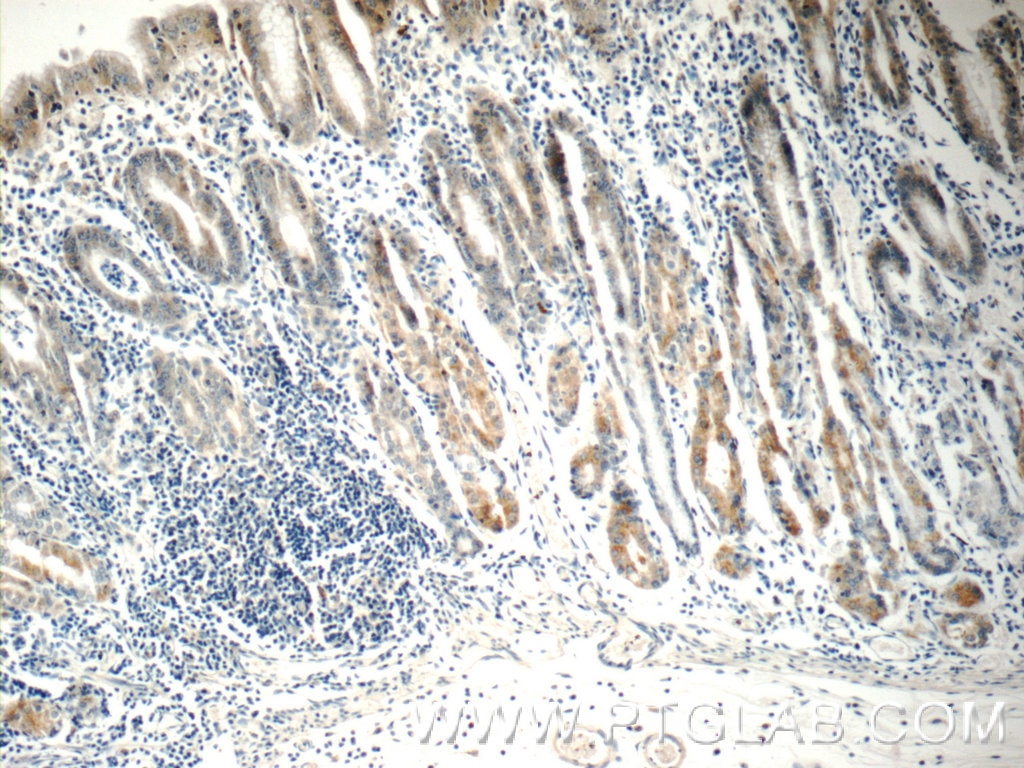 IHC staining of human stomach using 10844-1-AP