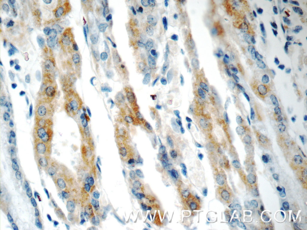 Immunohistochemistry (IHC) staining of human stomach tissue using IL-1RA Polyclonal antibody (10844-1-AP)