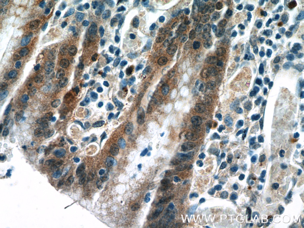 Immunohistochemistry (IHC) staining of human stomach tissue using IL-1RA Polyclonal antibody (10844-1-AP)