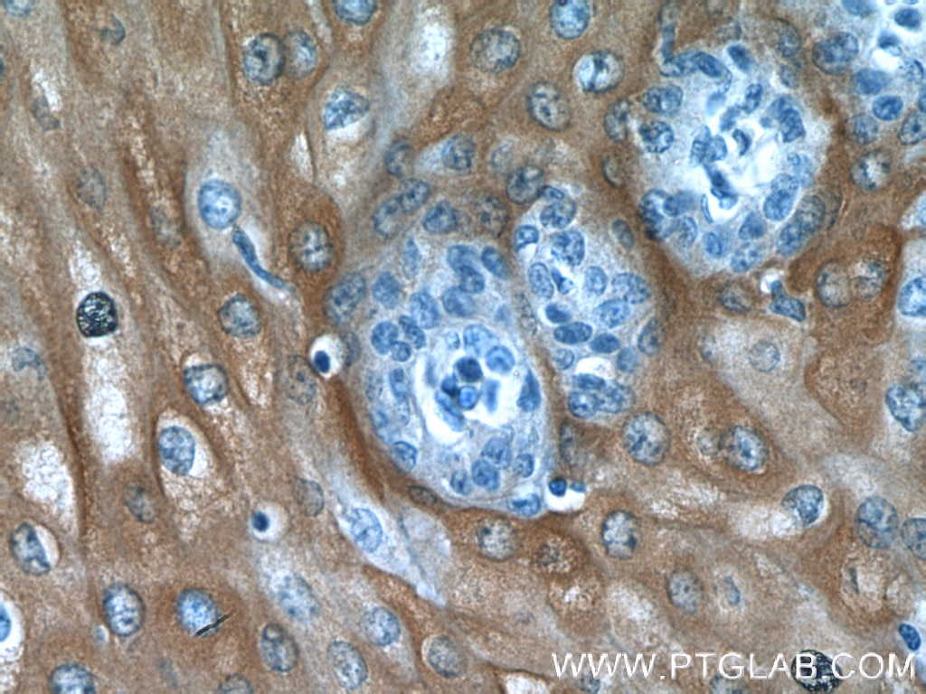 Immunohistochemistry (IHC) staining of human oesophagus tissue using IL-1RA Polyclonal antibody (10844-1-AP)
