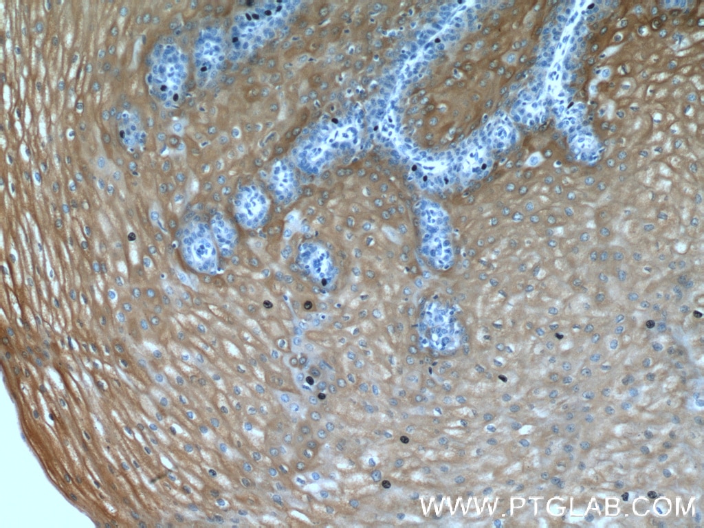 IHC staining of human oesophagus using 10844-1-AP