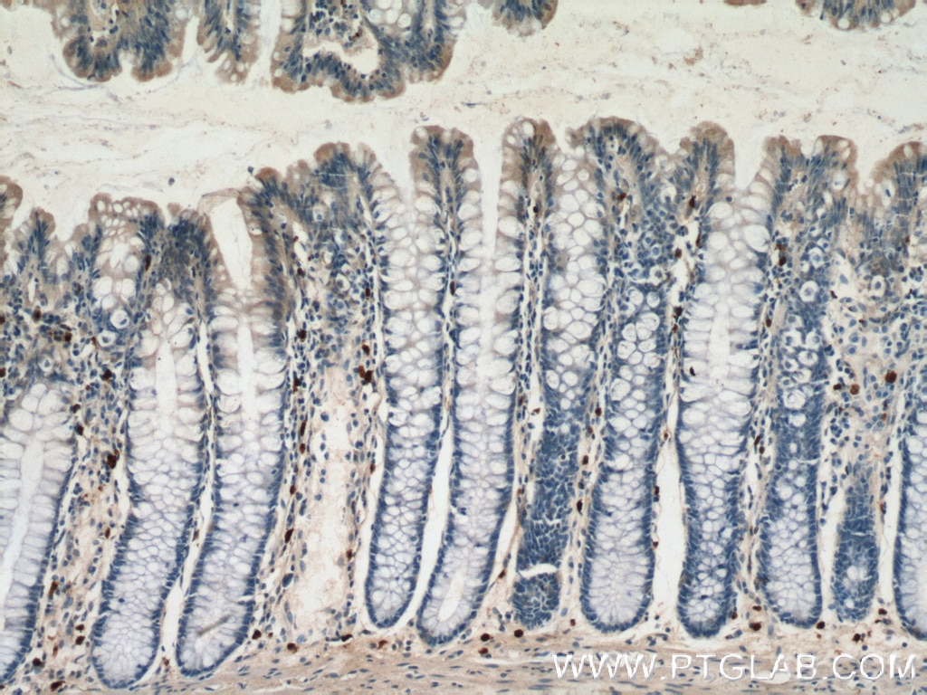 IHC staining of human colon using 10844-1-AP