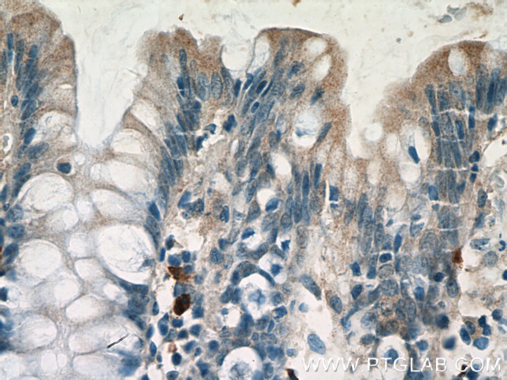 Immunohistochemistry (IHC) staining of human colon tissue using IL-1RA Polyclonal antibody (10844-1-AP)