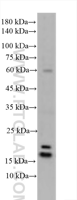 Western Blot (WB) analysis of various lysates using IL-1RA Polyclonal antibody (10844-1-AP)