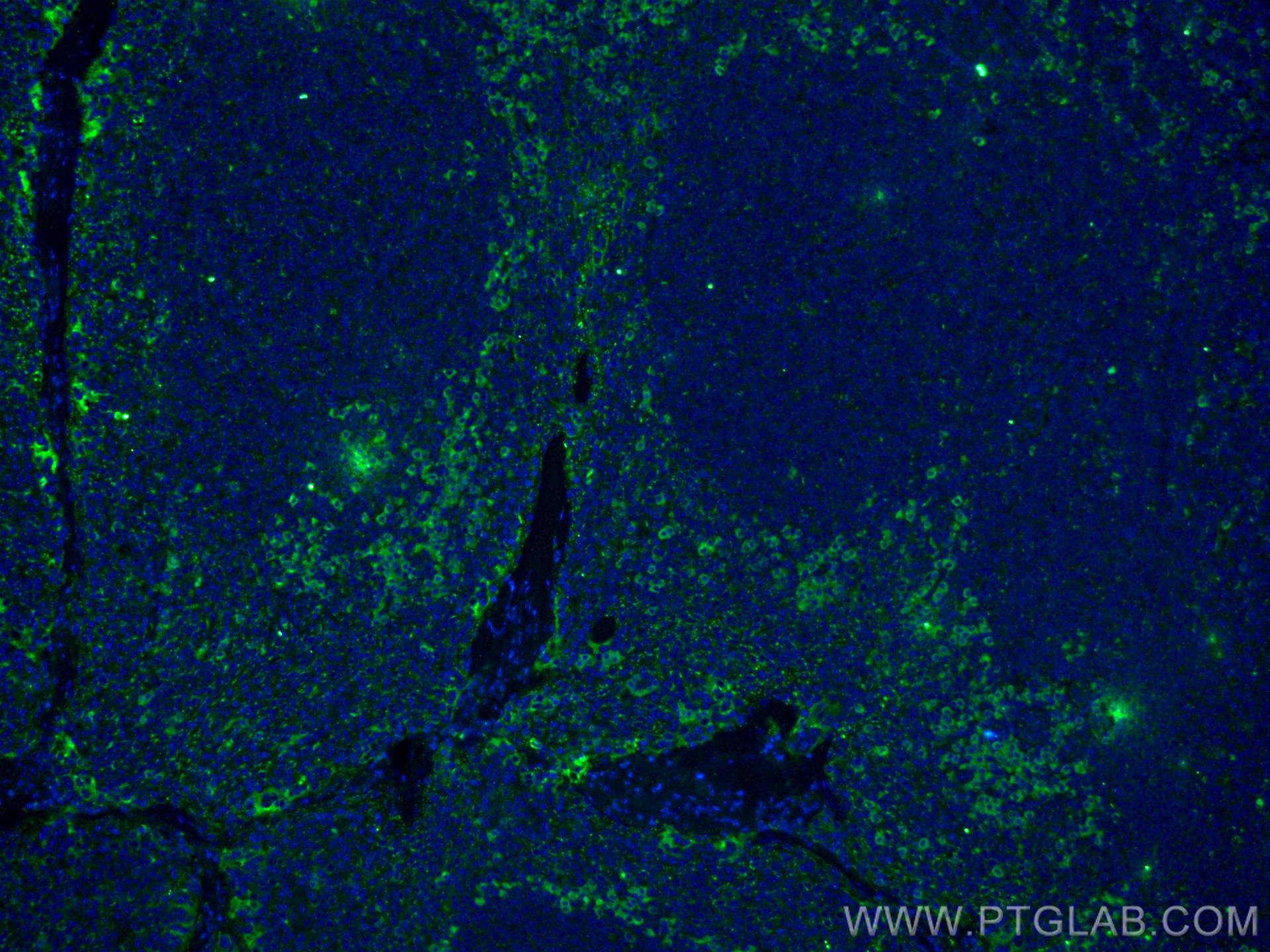 Immunofluorescence (IF) / fluorescent staining of human tonsillitis tissue using IL-2 Monoclonal antibody (60306-1-Ig)