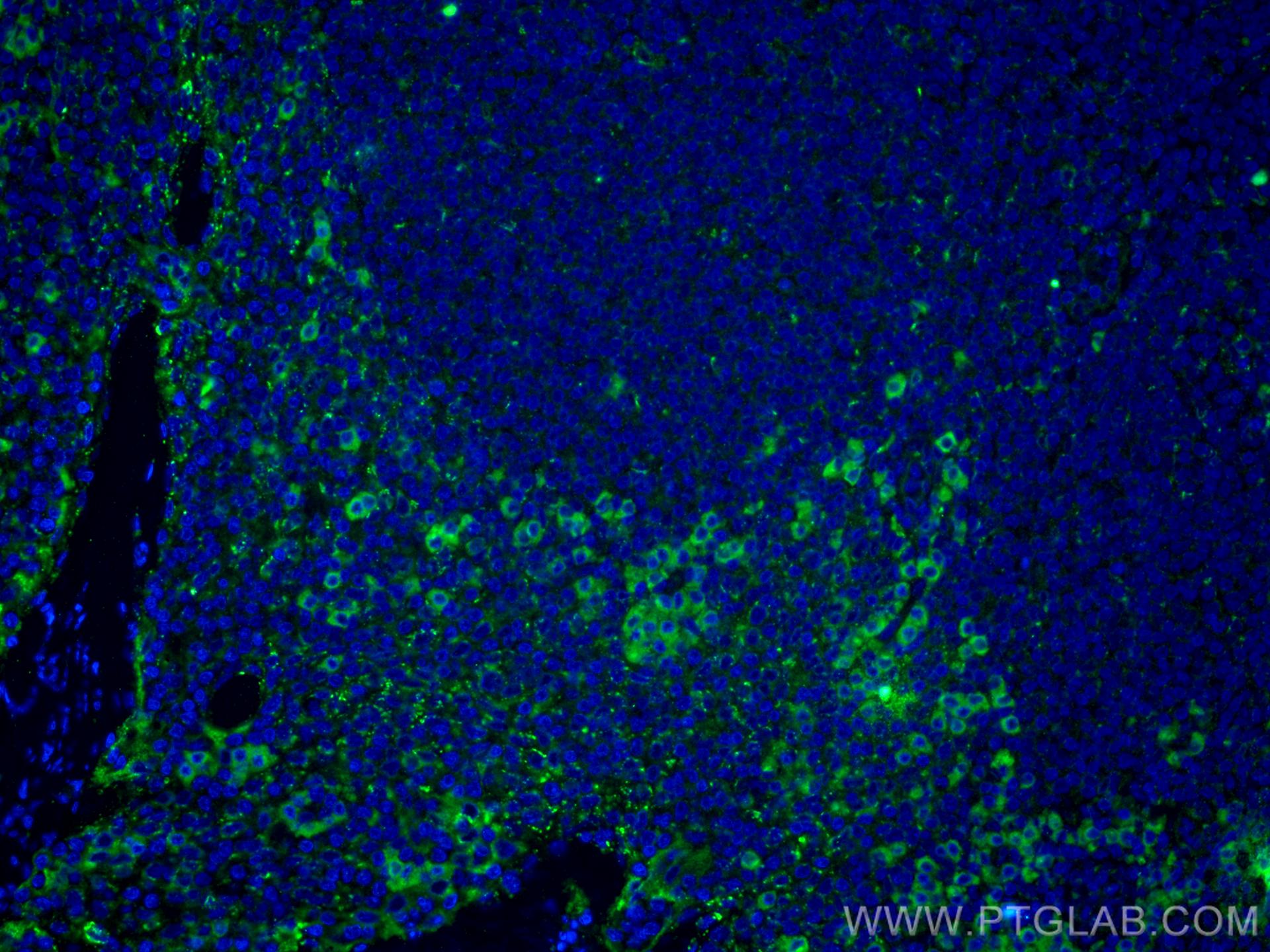 Immunofluorescence (IF) / fluorescent staining of human tonsillitis tissue using IL-2 Monoclonal antibody (60306-1-Ig)