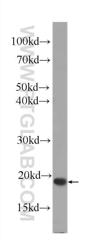 Western Blot (WB) analysis of Jurkat cells using IL-2 Monoclonal antibody (60306-1-Ig)