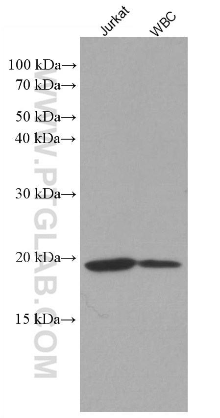 Western Blot (WB) analysis of Jurkat cells using IL-2 Monoclonal antibody (60306-1-Ig)