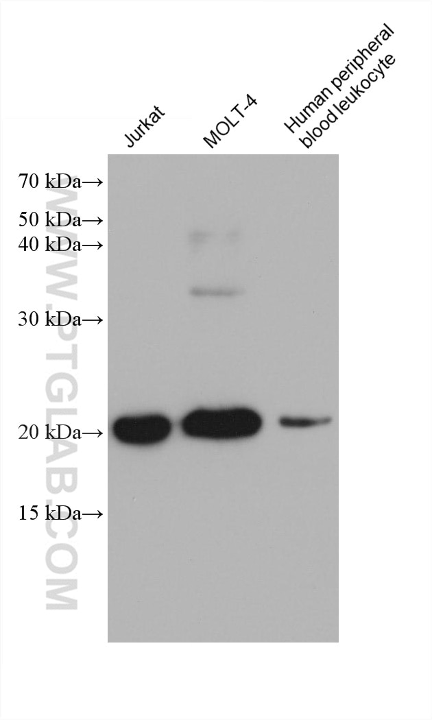 Western Blot (WB) analysis of various lysates using IL-2 Monoclonal antibody (60306-1-Ig)