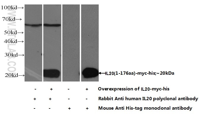 Western Blot (WB) analysis of HEK-293 cells using IL-20 Polyclonal antibody (18104-1-AP)