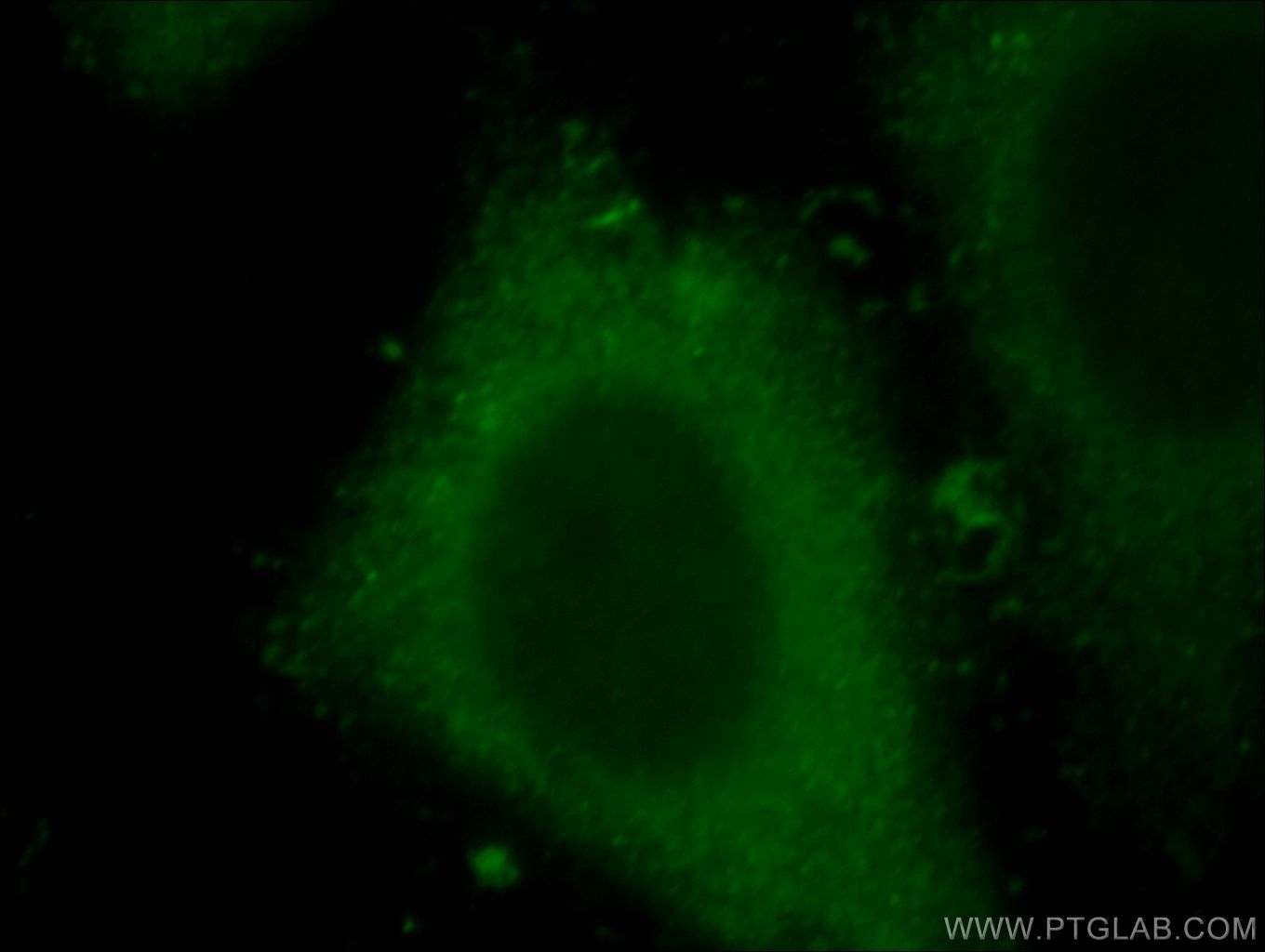 Immunofluorescence (IF) / fluorescent staining of HepG2 cells using IL-20RB Polyclonal antibody (20521-1-AP)