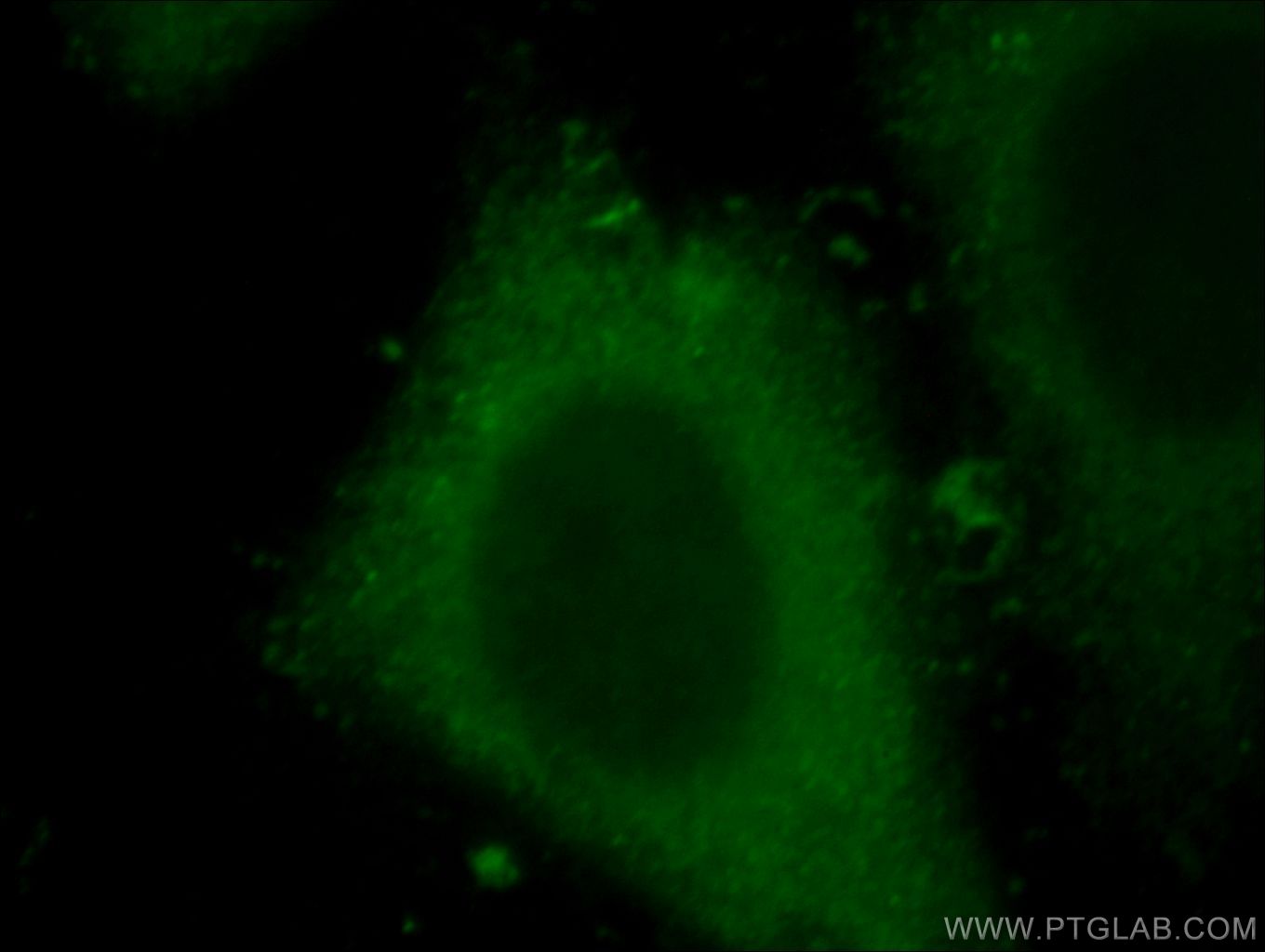 IF Staining of HepG2 using 20521-1-AP