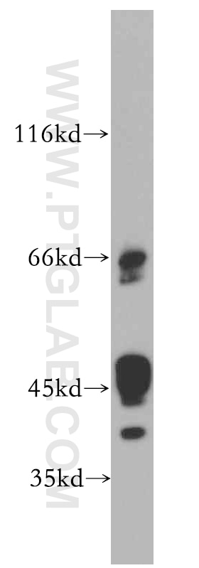 Western Blot (WB) analysis of MCF-7 cells using IL-20RB Polyclonal antibody (20521-1-AP)