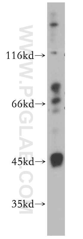 Western Blot (WB) analysis of HeLa cells using IL-20RB Polyclonal antibody (20521-1-AP)