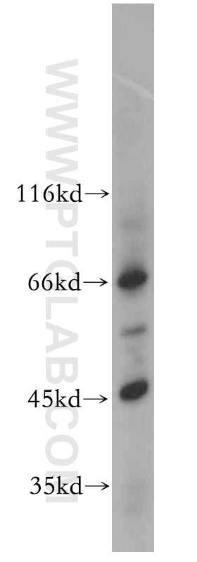Western Blot (WB) analysis of K-562 cells using IL-20RB Polyclonal antibody (20521-1-AP)