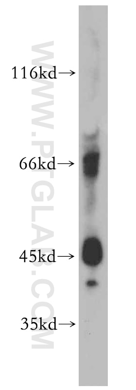 Western Blot (WB) analysis of Apoptosised HeLa cells using IL-20RB Polyclonal antibody (20521-1-AP)