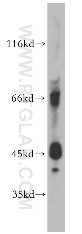 WB analysis of Apoptosised HeLa using 20521-1-AP