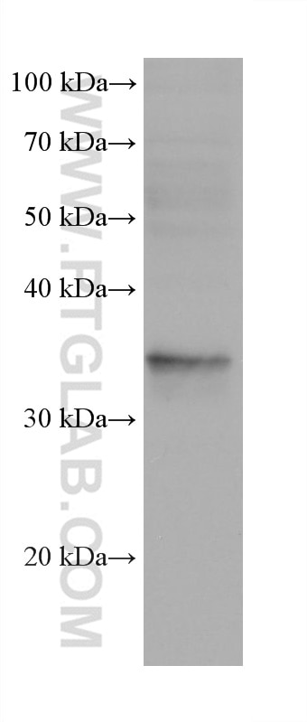 Western Blot (WB) analysis of MCF-10A cells using IL-20RB Monoclonal antibody (60221-1-Ig)
