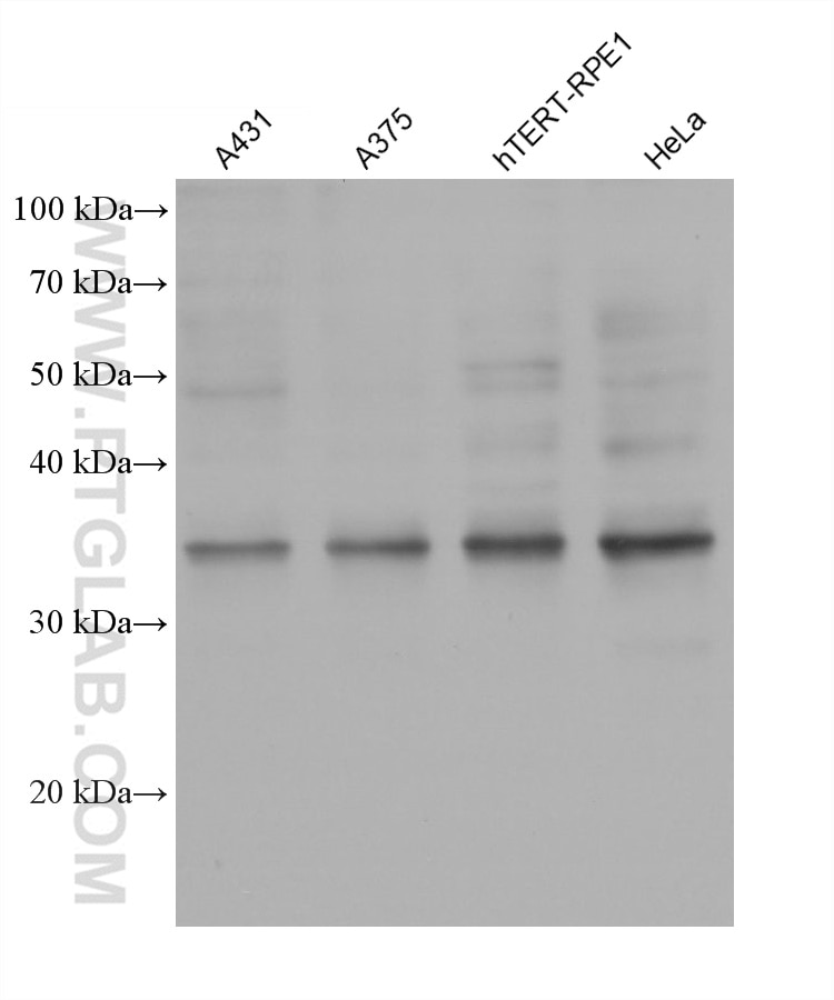 Western Blot (WB) analysis of various lysates using IL-20RB Monoclonal antibody (60221-1-Ig)