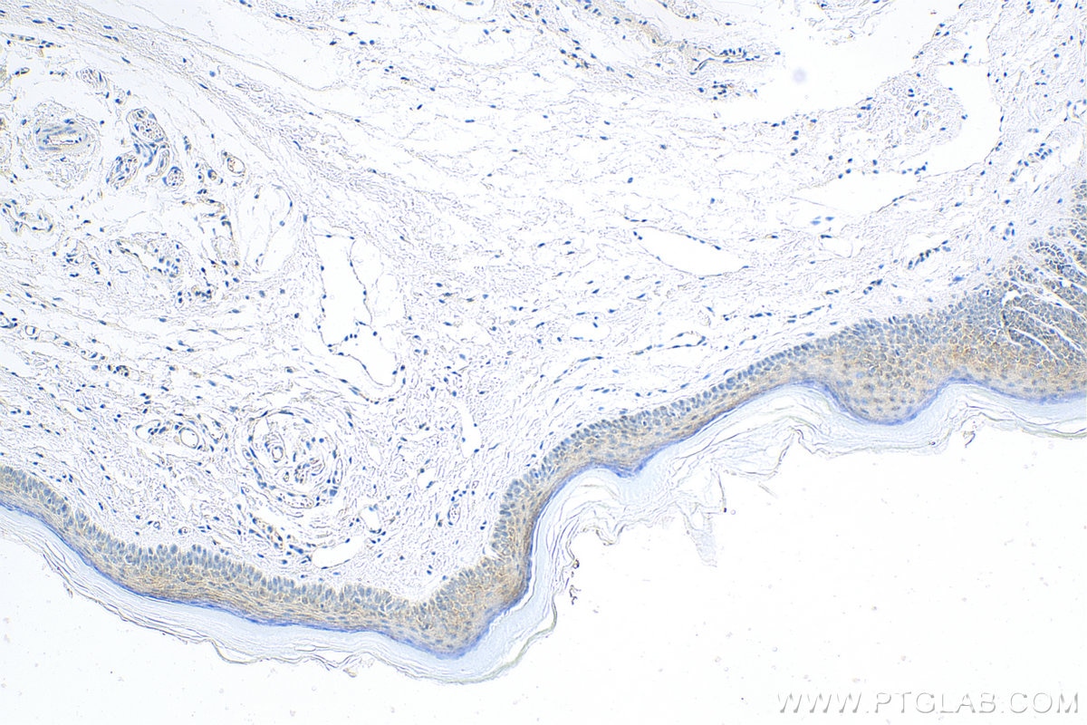 Immunohistochemistry (IHC) staining of mouse skin tissue using IL-21 Polyclonal antibody (17625-1-AP)
