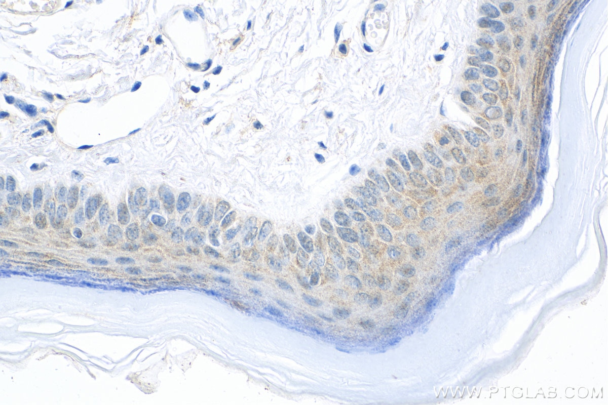 Immunohistochemistry (IHC) staining of mouse skin tissue using IL-21 Polyclonal antibody (17625-1-AP)