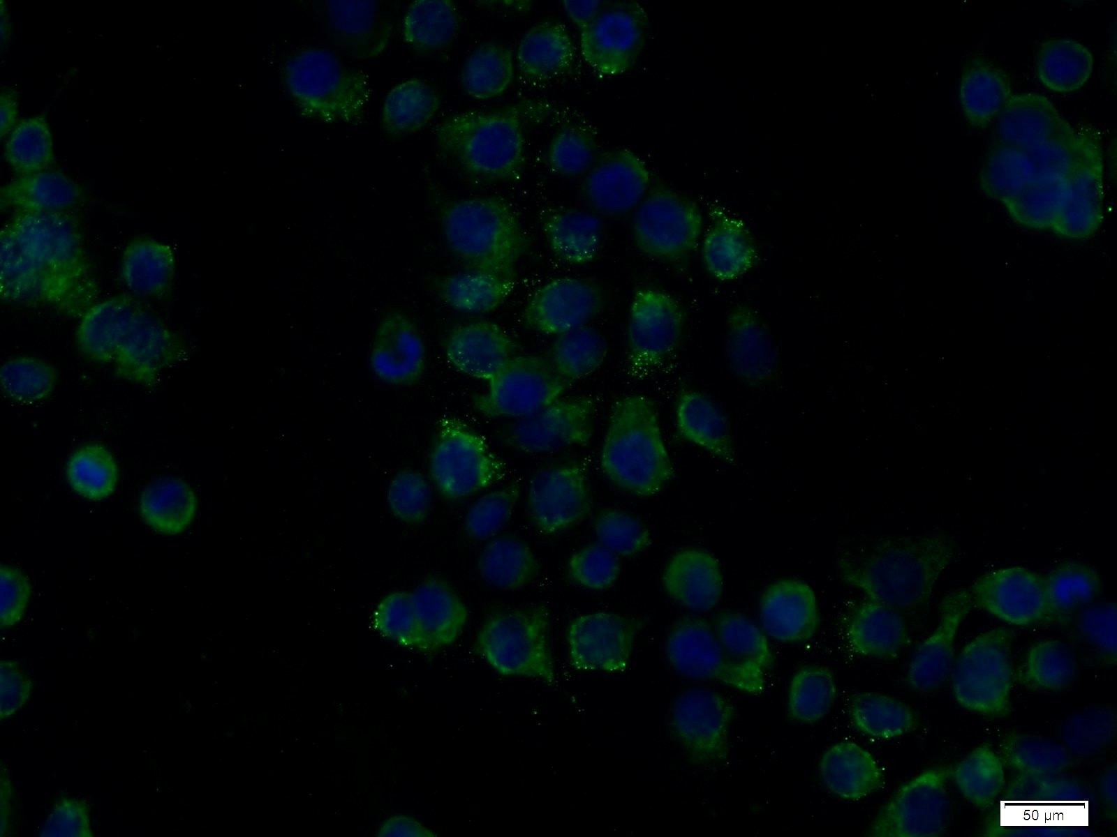 Immunofluorescence (IF) / fluorescent staining of COLO 320 cells using IL-21R Polyclonal antibody (10533-1-AP)