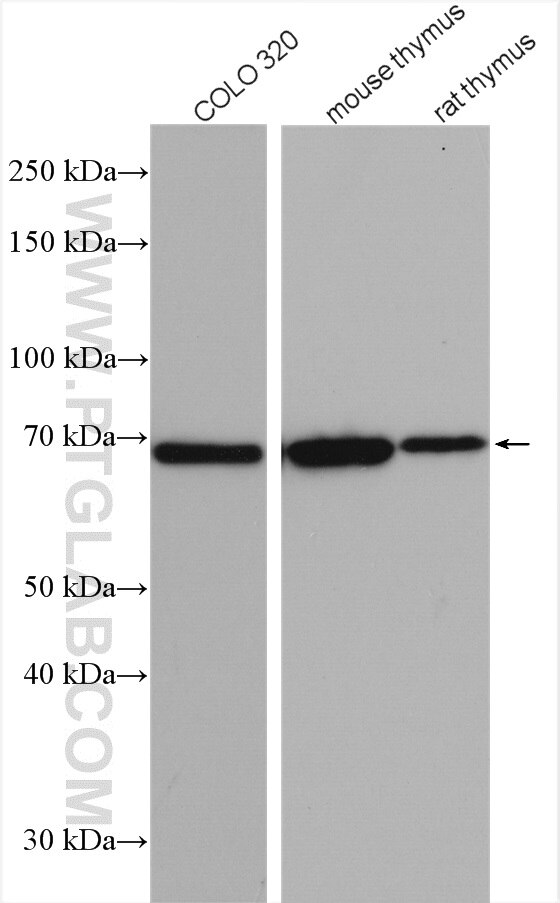 Western Blot (WB) analysis of various lysates using IL-21R Polyclonal antibody (10533-1-AP)