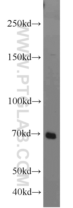 Western Blot (WB) analysis of K-562 cells using IL-21R Polyclonal antibody (10533-1-AP)