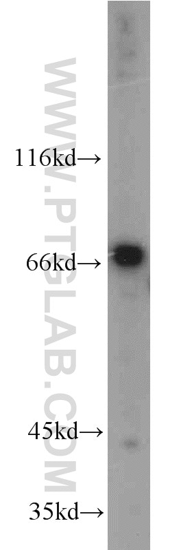 Western Blot (WB) analysis of mouse thymus tissue using IL-21R Polyclonal antibody (10533-1-AP)