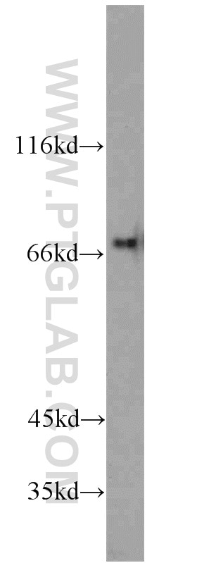 Western Blot (WB) analysis of Raji cells using IL-21R Polyclonal antibody (10533-1-AP)