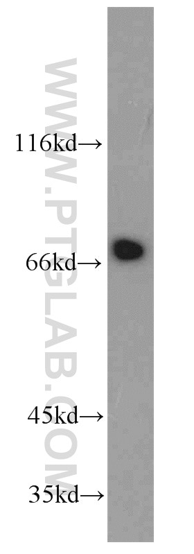 Western Blot (WB) analysis of COLO 320 cells using IL-21R Polyclonal antibody (10533-1-AP)