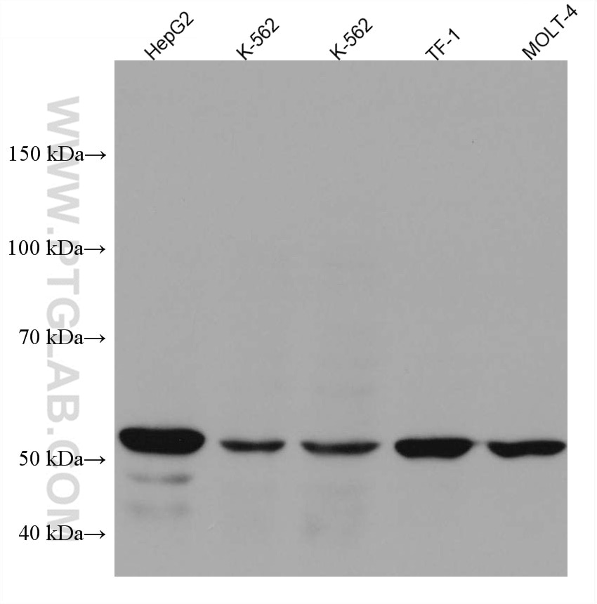 Western Blot (WB) analysis of various lysates using IL-21R Monoclonal antibody (66319-1-Ig)
