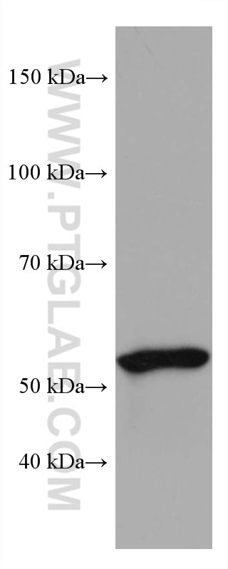 Western Blot (WB) analysis of human placenta tissue using IL-21R Monoclonal antibody (66319-1-Ig)