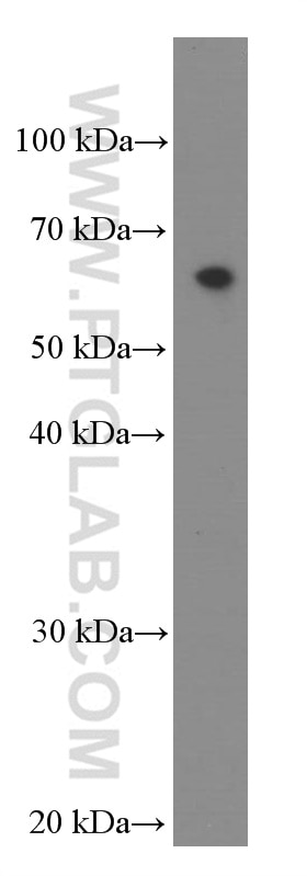 Western Blot (WB) analysis of Jurkat cells using IL-21R Monoclonal antibody (66319-1-Ig)