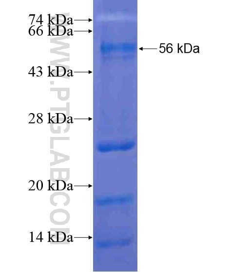 IL-21R fusion protein Ag21295 SDS-PAGE