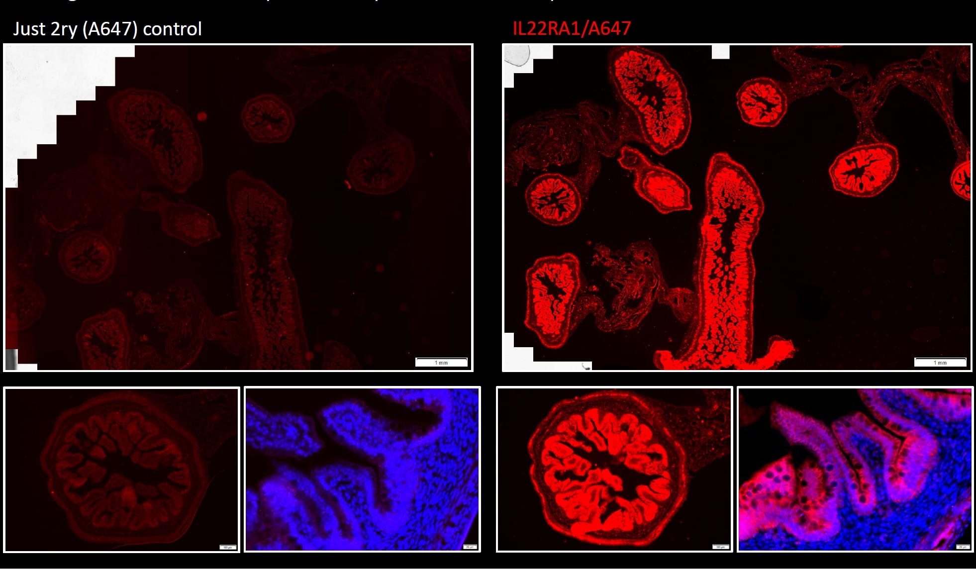 Immunofluorescence (IF) / fluorescent staining of human gut using IL-22RA1 Polyclonal antibody (13462-1-AP)