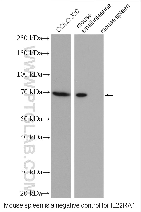 Western Blot (WB) analysis of various lysates using IL-22RA1 Polyclonal antibody (13462-1-AP)