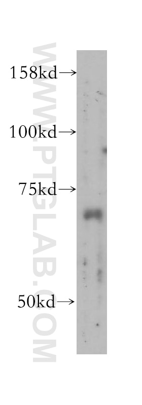 IL-22RA1 Polyclonal antibody