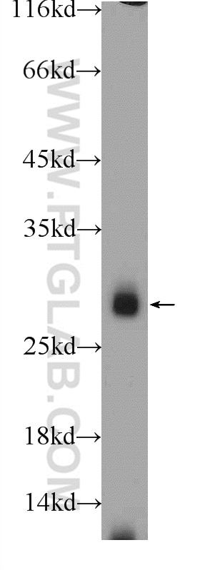 Western Blot (WB) analysis of MDA-MB-453s cells using IL-22RA2 Polyclonal antibody (22861-1-AP)