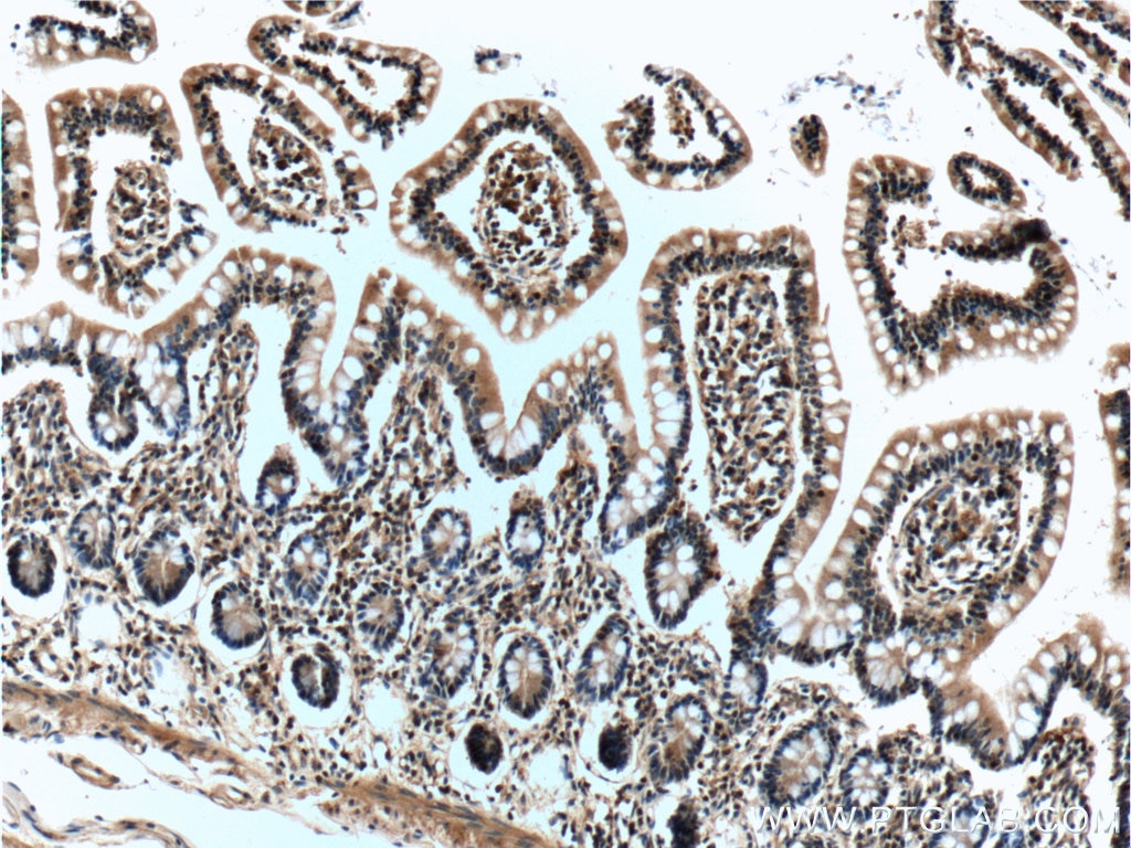 Immunohistochemistry (IHC) staining of human small intestine tissue using IL-22RA2 Monoclonal antibody (66190-1-Ig)