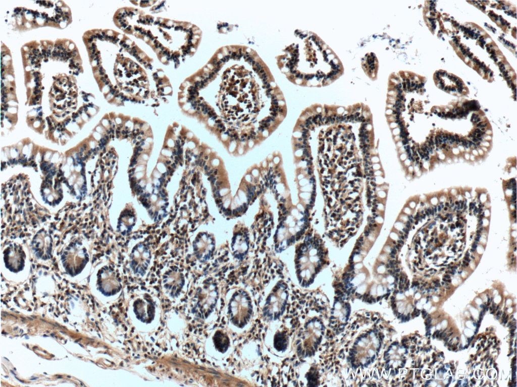 IHC staining of human small intestine using 66190-1-Ig