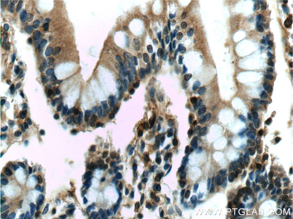 Immunohistochemistry (IHC) staining of human small intestine tissue using IL-22RA2 Monoclonal antibody (66190-1-Ig)