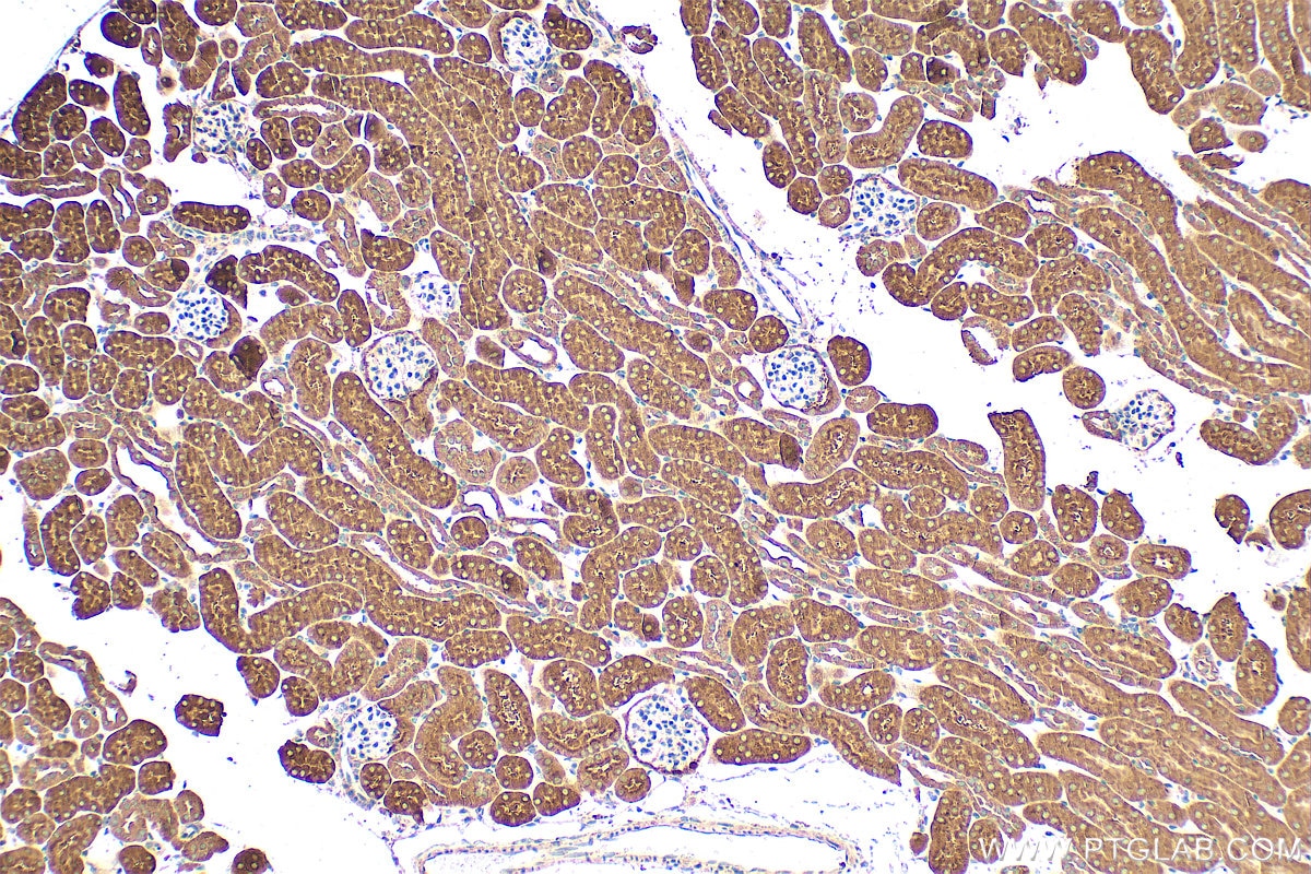 Immunohistochemistry (IHC) staining of mouse kidney tissue using IL-22RA2 Monoclonal antibody (66190-1-Ig)