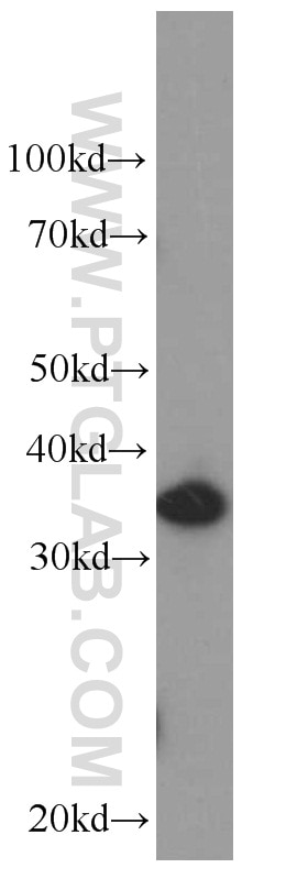 Western Blot (WB) analysis of Raji cells using IL-22RA2 Monoclonal antibody (66190-1-Ig)