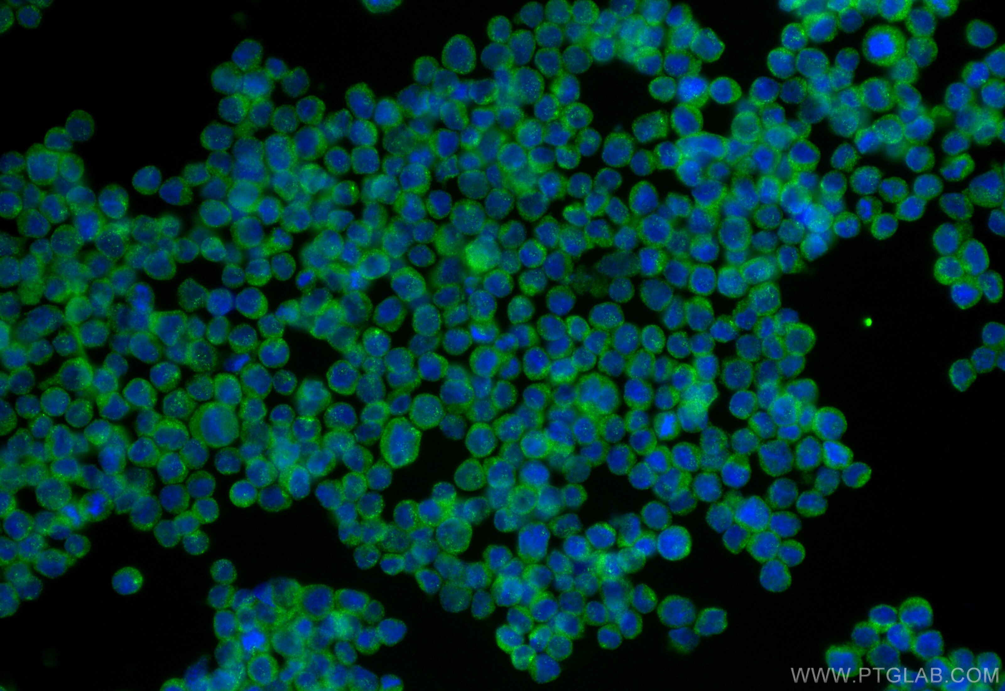 Immunofluorescence (IF) / fluorescent staining of Raji cells using IL23(IL12B+IL23A) Polyclonal antibody (32180-1-AP)