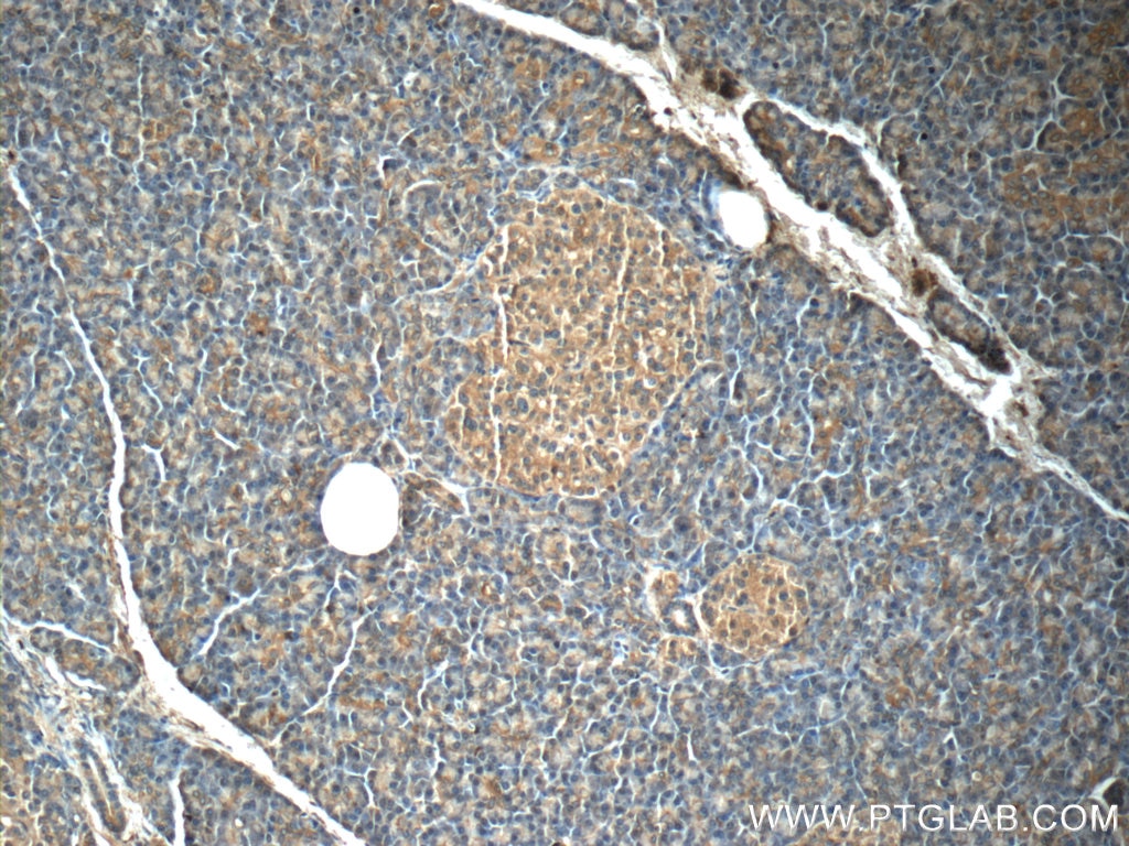 IHC staining of human pancreas using 66196-1-Ig