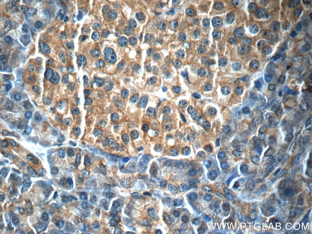 IHC staining of human pancreas using 66196-1-Ig