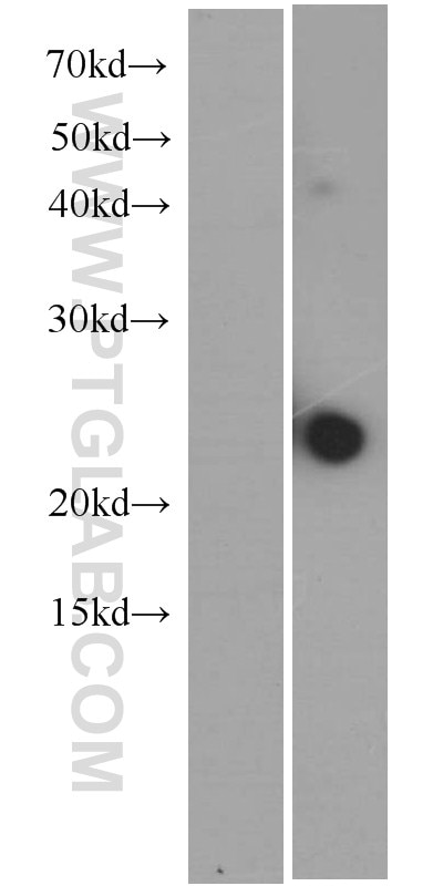 IL-23A Monoclonal antibody