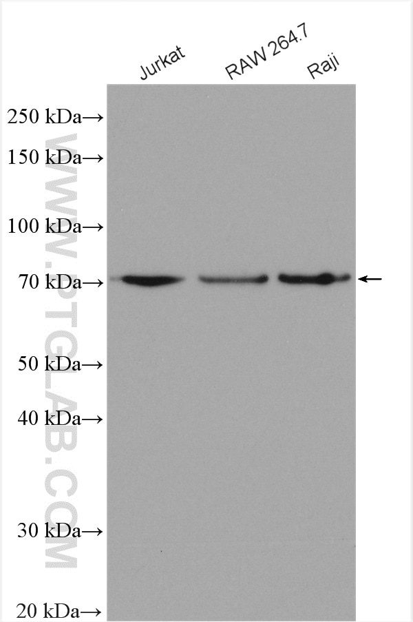 Western Blot (WB) analysis of various lysates using IL-23R Polyclonal antibody (27163-1-AP)