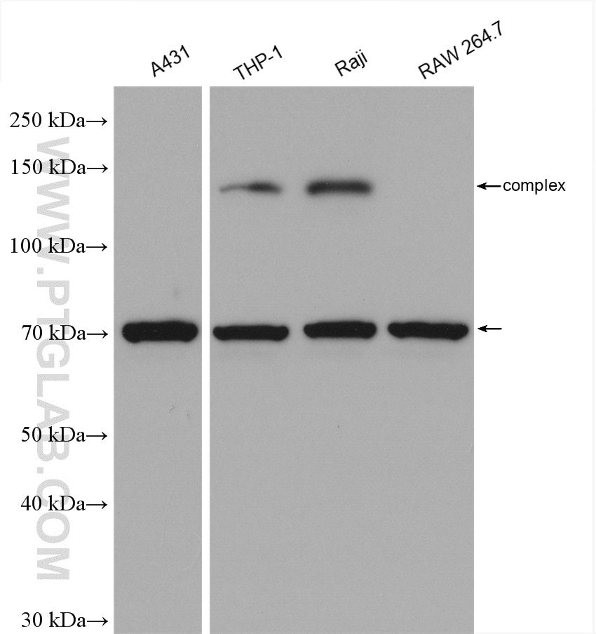 Western Blot (WB) analysis of various lysates using IL-23R Polyclonal antibody (27163-1-AP)